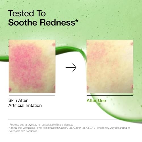 Azelaic Acid 10 Hyaluron Redness Soothing Serum 30Ml